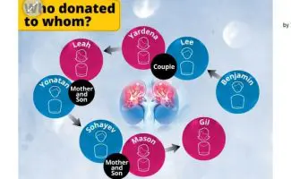 An extraordinary 8-way kidney surgery involving 4 donors and 4 recipients